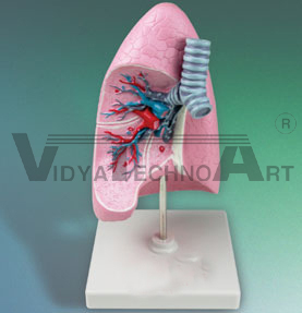 Lung Model